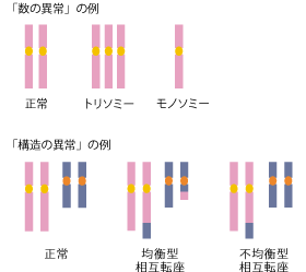 染色体異常とは